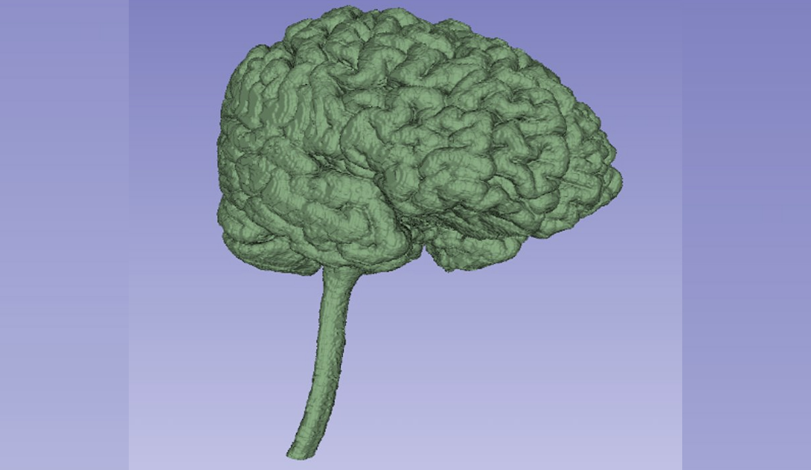 Brain Pressure