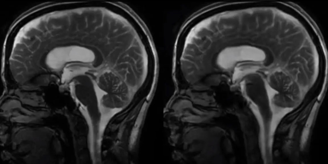 The Beating Brain