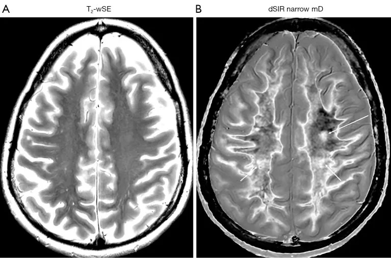 Leading revolution in MRI contrast weighting