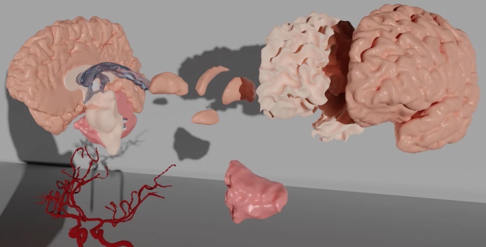 New insight into dementia at Mātai Medical Research Institute presentation